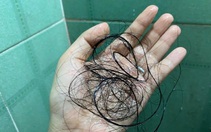 Tăng người bệnh hậu COVID-19