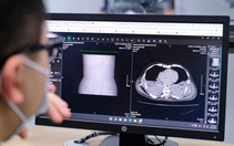 Tin sáng 30-3: Đến nay Hà Nội gần 1,5 triệu ca COVID-19, cứ 5 người có 1 người nhiễm