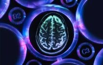 Giấc ngủ ngày dài hơn là dấu hiệu ban đầu của bệnh Alzheimer