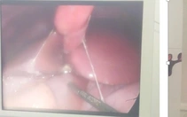 Nghi vấn bệnh nhi mắc COVID-19 bị thủng dạ dày vì dùng thuốc không đúng cách