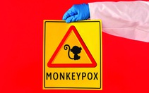 Không "đậu mùa khỉ" thì là gì?
