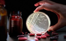 Xác định loại kháng sinh phổ biến có liên quan đến siêu vi khuẩn nguy hiểm