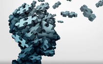 Khuyết tật nhận thức ở người trẻ: Những biểu hiện đầu tiên của 'brain rot'