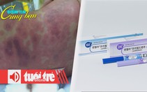 Điểm tin 8h: Dịch viêm não mô cầu ở Thái Bình; Tiêm hormone tăng chiều cao cho con
