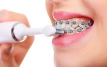 Ăn gì, vệ sinh răng thế nào khi đang niềng răng?
