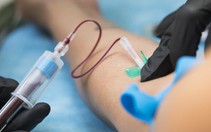Xét nghiệm máu phát hiện ADN ung thư từ 3 năm trước khi chẩn đoán
