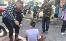 Một TikToker bị chém gần đứt lìa bàn tay