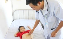 Phẫu thuật lấy búi tóc nặng nửa ký khỏi dạ dày bệnh nhi 5 tuổi