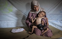 Bức ảnh cậu bé gầy trơ xương vì đói ở Gaza bị tố là ảnh giả