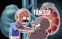 Đắk Lắk: Tán sỏi cho 480 bệnh nhân dù máy đã hỏng 2 năm
