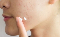 Một công ty bị thu hồi, đình chỉ lưu hành 77 loại mỹ phẩm