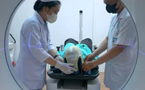 Bệnh nhân u não được ứng dụng xạ trị điều biến liều tại Cần Thơ