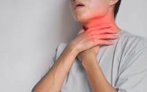 Đau họng kéo dài dù không ốm sốt hay cảm lạnh, nên nghĩ đến bệnh gì?