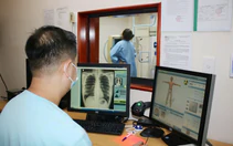 Đau bụng, đau đầu, ho dai dẳng kéo dài có nhất thiết nội soi hay chụp CT, MRI tầm soát?
