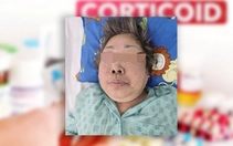 'Uống thấy dễ chịu' nhưng khuôn mặt biến dạng, suy thượng thận mạn vì lạm dụng corticoid