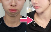 Ảnh quá khứ khó tin của 'nữ thần điền kinh Hàn Quốc'