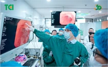 Khi nào người trẻ nên đi nội soi tiêu hóa?