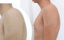 Cổ rụt, lưng gù vì ngồi vẹo vọ, bò dài trên bàn: Chữa thế nào?