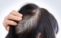 Mới chút xíu tuổi tóc đã bạc