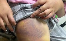 Đừng để trẻ gánh hậu quả từ thất bại của người lớn