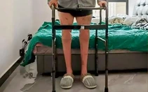 Lần đầu tiên trên thế giới: Bác sĩ Trung Quốc nối thành công hai chân đứt lìa
