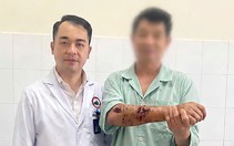Đứt lìa tay chân, sơ cứu kiểu gì để nối lại được?