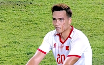 Bùi Hoàng Việt Anh đổ máu trong trận Indonesia - Việt Nam