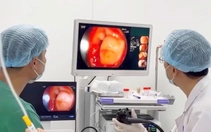 Trẻ xuất huyết tiêu hóa tăng, nhiều phụ huynh nhầm với đau bụng thông thường