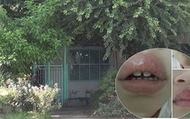 Ngừng hoạt động nhà trẻ bạo hành trẻ bằng ớt