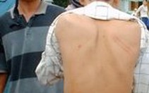 Vụ cấp cứu do bị CSGT rượt đuổi: Nạn nhân còn bị đánh đập