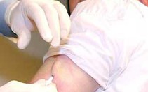 FDA chấp thuận cấy chip lên người