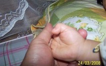 Ngón tay cò súng
