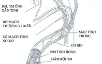 Giãn tĩnh mạch thừng tinh và vô sinh nam