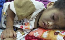 Cháu bé ba tuổi bị hành hạ dã man: Bị đánh vì không phải con ruột?