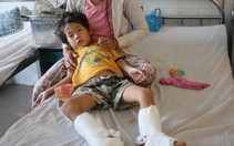 Đà Nẵng: một đứa trẻ bị chém đứt gân 2 chân