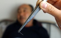 Ngồi trên mũi kim gãy 31 năm!