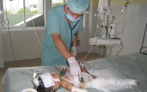 "Bỏng mùa hè" - tai nạn không đáng có