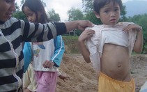 Dịch ghẻ ở Quảng Nam