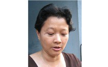 Dây diều rơi cắt mí mắt
