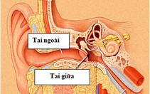 Phẫu thuật tai có biến chứng liệt mặt ?