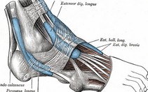 Xương bàn chân lâu hồi phục