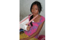 Bắt tạm giam cậu đánh cháu ruột gãy tay