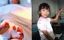 Bàn tay được ghép vào chân