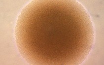 Phát hiện gene chuyển từ người sang vi khuẩn