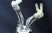 Robot "cua" điều trị ung thư dạ dày