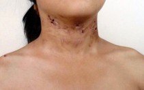 Điều tra vụ tố giác bố đẻ và mẹ kế bạo hành con gái 6 tuổi