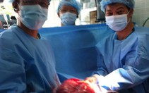 Phẫu thuật lấy khối u "khủng" trong lồng ngực bệnh nhân