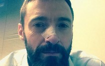 "Người sói" Hugh Jackman: ung thư da vẫn đi quảng bá phim