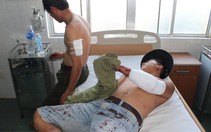 ​Đắk Nông: 3 nhân viên bảo vệ rừng bị chém trọng thương