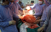 ​Chủ quan, u mỡ thành u khổng lồ